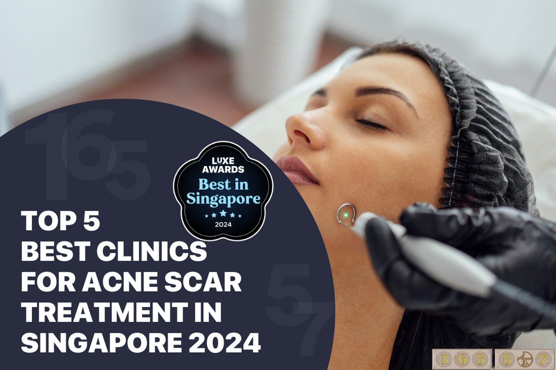 Top 5 Best Clinics for Acne Scar Treatment in Singapore 2024