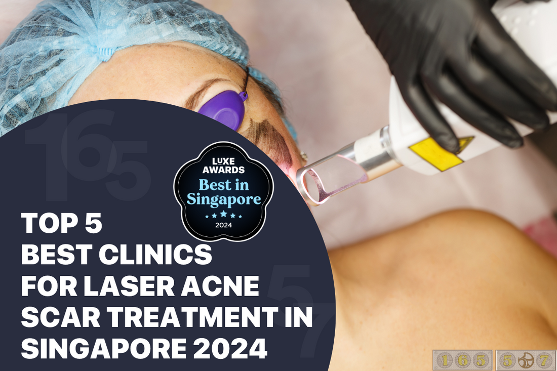 Top 5 Best Clinics for Laser Acne Scar Treatment in Singapore 2024