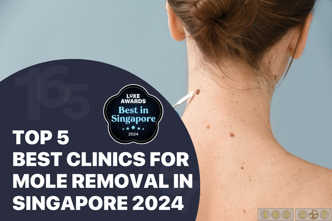 Top 5 Best Clinics for Mole Removal in Singapore 2024