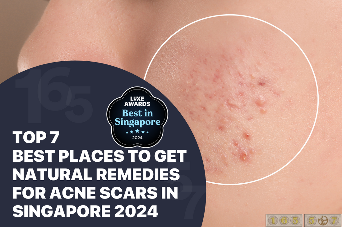 Top 7 Best Places to Get Natural Remedies for Acne Scars in Singapore 2024